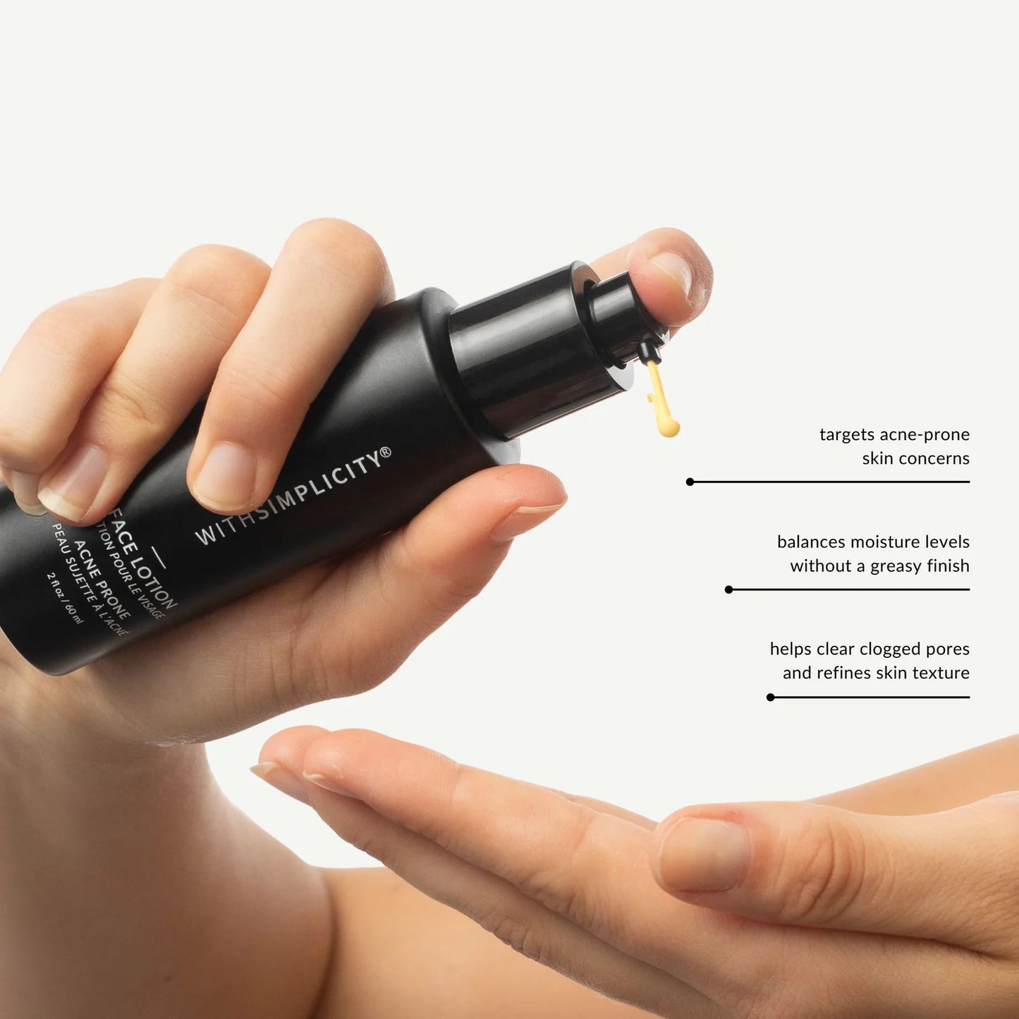 Face Lotion - Acne Prone Skin